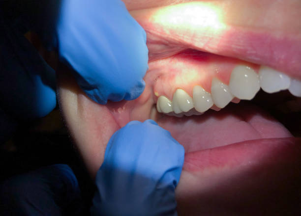 Best Tooth Pain Emergency Relief  in Sterling, KS