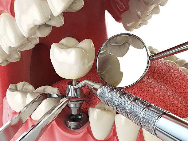 Best Cracked Tooth Emergency Dentist  in Sterling, KS